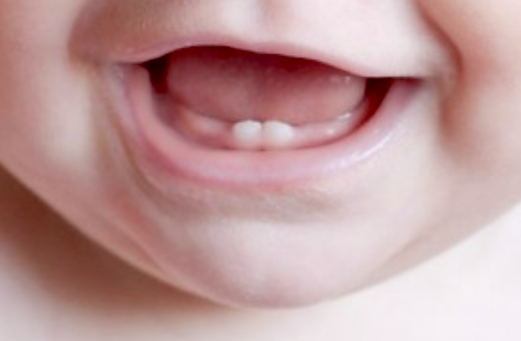 Foto 1 del artículo del Doctor Oriol Quevedo sobre ¿Cuándo se forman los dientes? ¿Cuándo le saldrá el primer diente a mi bebé? ¿Cuántos dientes debería tener mi hijo? ¿Cuándo le caerán los dientes a mi hijo?