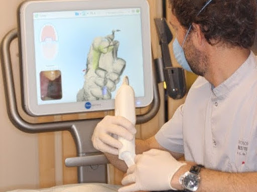Doctor Fernando de la Iglesia utilizando el escaner intraoral 3D ITERO