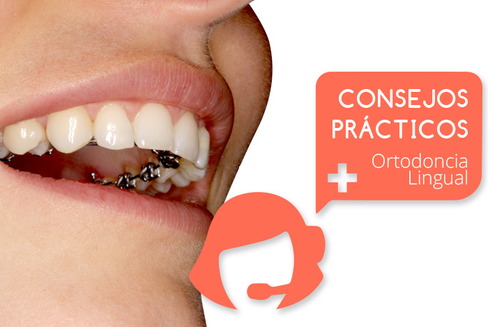 Los brackets linguales que Ortodoncia Tres Torres Barcelona utiliza en los tratamientos de ortodoncia lingual son los más pequeños del mercado