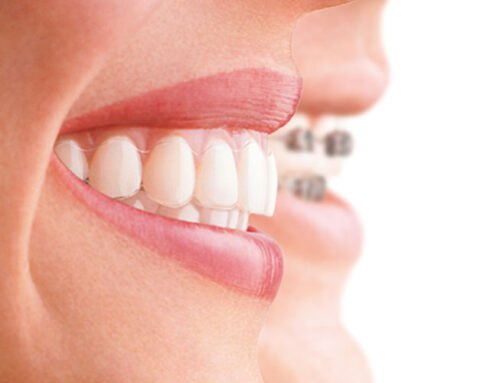 Técnicas para mejorar la higiene bucodental con ortodoncia