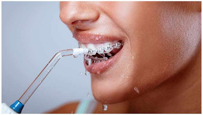 Primer plano del rostro de una mujer utilizando un irrigador bucal para eliminar restos de comida entre los dientes o en los brackets

