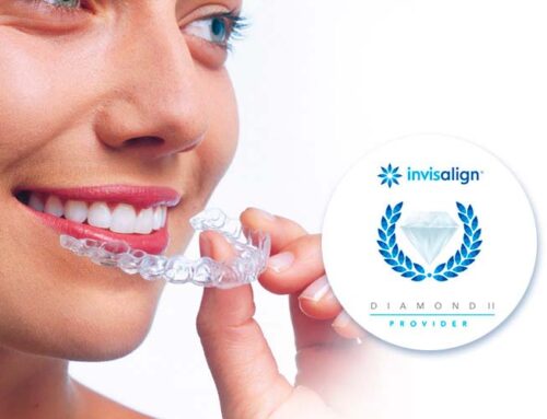 Invisalign Diamond Provider en Barcelona: Ortodoncia Tres Torres Barcelona obtiene la máxima certificación en ortodoncia invisible