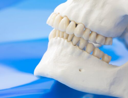 Retrognatia: dientes inferiores atrasados y cómo solucionarlo
