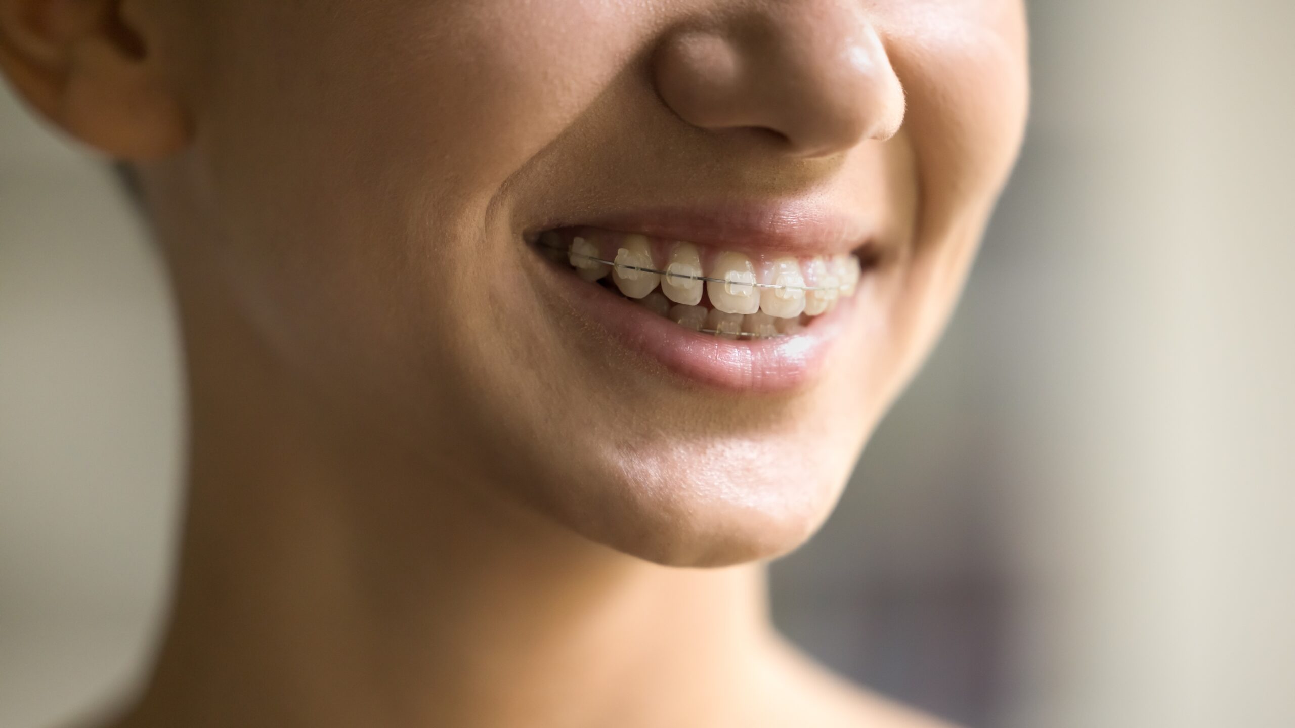 dientes de arriba hacia fuera