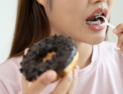 ¿Qué no hacer con los brackets recién puestos?