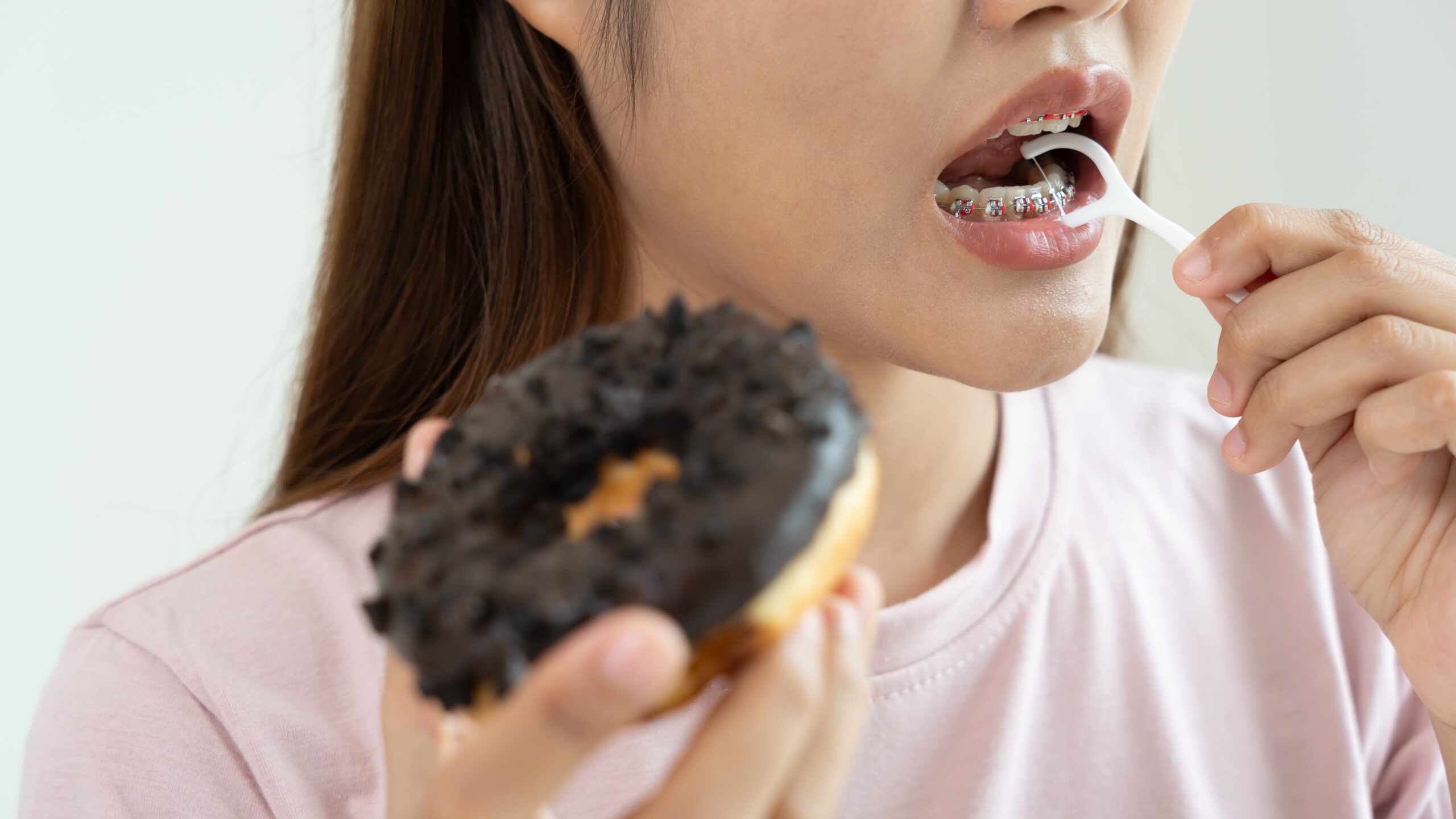 ¿Qué no hacer con los brackets recién puestos?