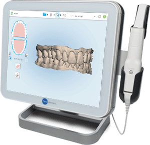 El tractament d'ortodòncia lingual s'inicia prenent digitalment impressions molt precises de les dents en 3D