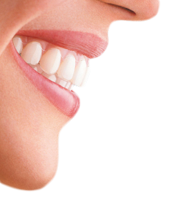 Primer pla d'una dentadura amb fundes Invisalign.
