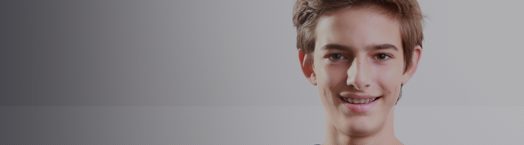 ortodoncia visible bracket ca